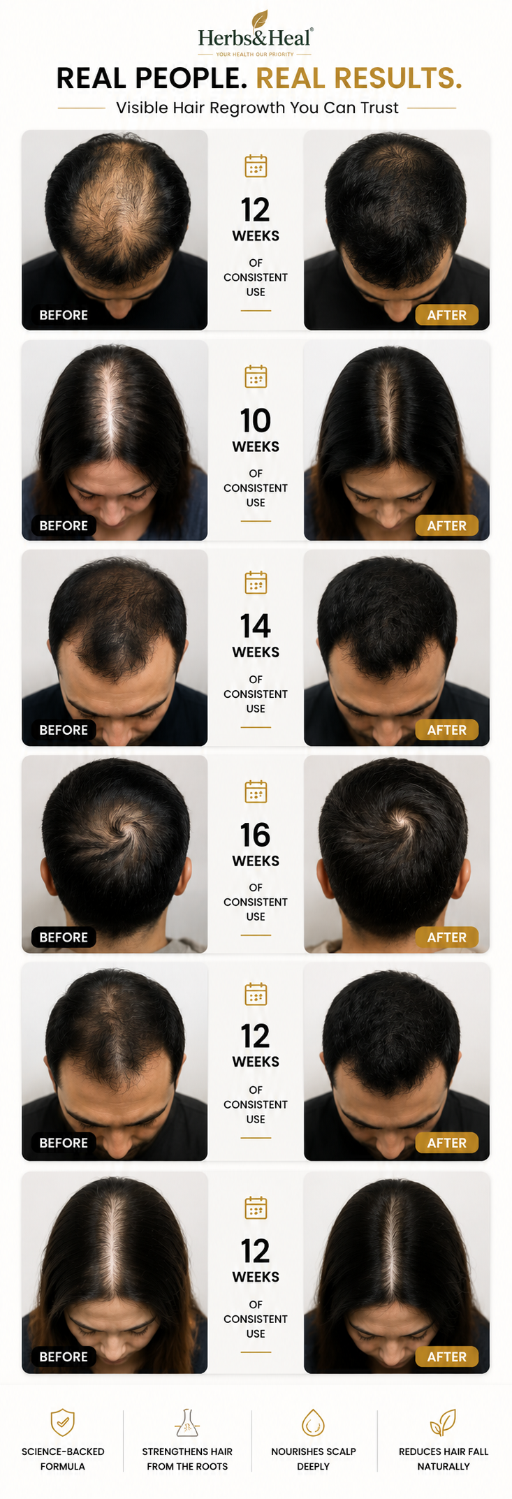 Herbs&Heal Minoxidil Serum